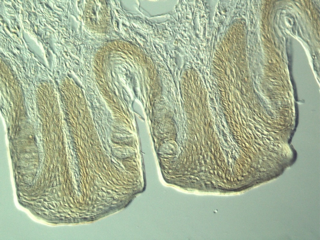 Metody optického kontrastu - BARIA