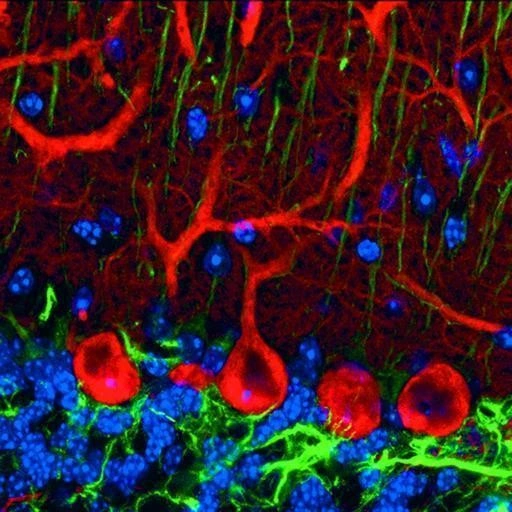 Fluorescenční mikroskopie - BARIA