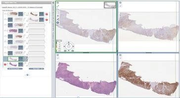 Digitální patologie - BARIA