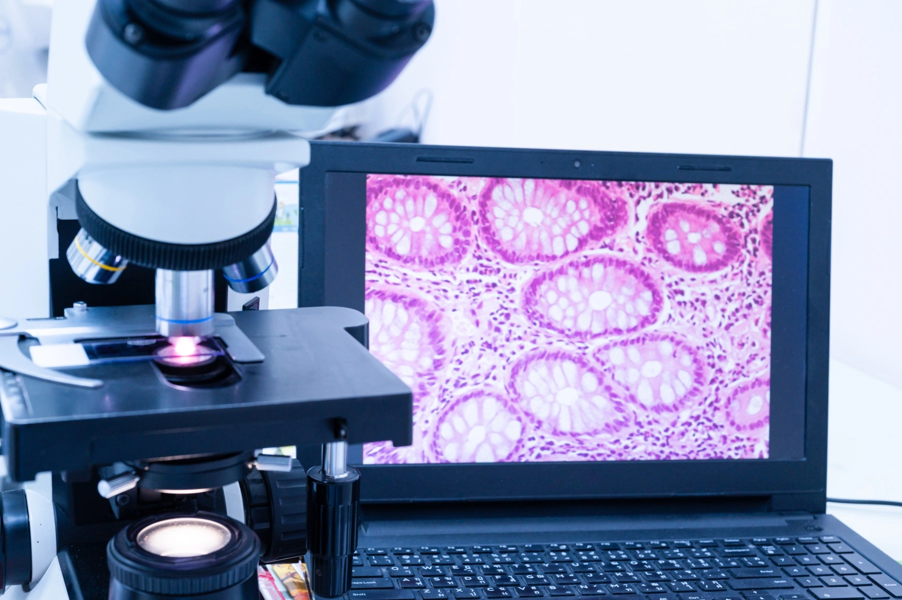 Jak specificky zacílit: blokátory v imunohistochemii - BARIA