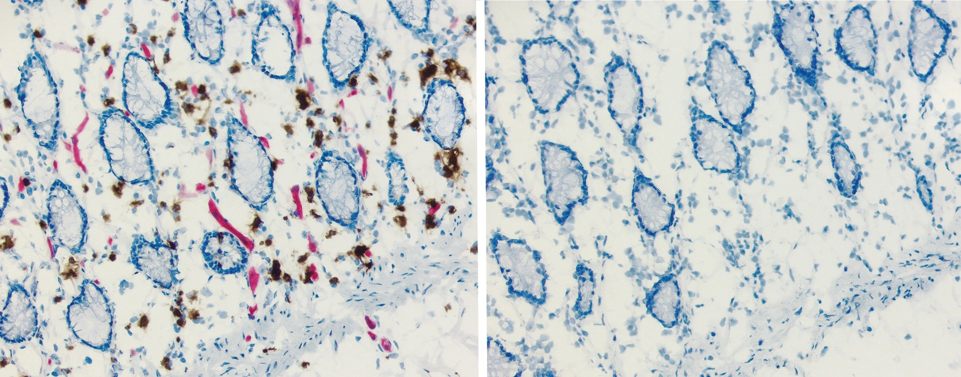 Jak specificky zacílit: blokátory v imunohistochemii - BARIA