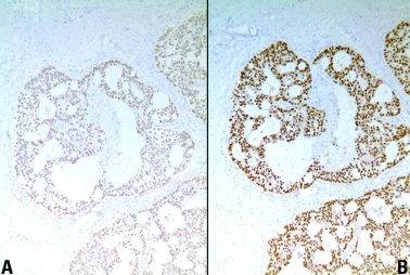 Vliv fixace a zpracování tkání na imunohistochemii - BARIA