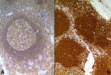 Vliv fixace a zpracování tkání na imunohistochemii - BARIA