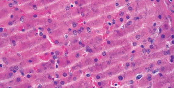 Příprava parafínových řezů na mikrotomu - BARIA