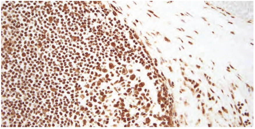 101 kroků: In situ hybridizace (ISH) - BARIA