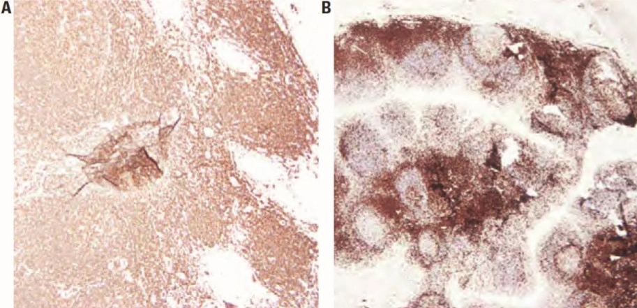 101 kroků: Imunohistochemie (IHC) - BARIA