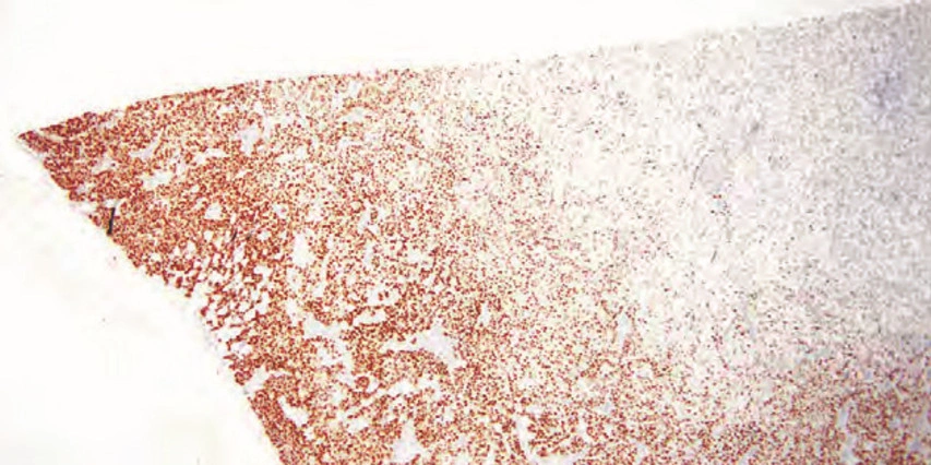 101 kroků: Imunohistochemie (IHC) - BARIA