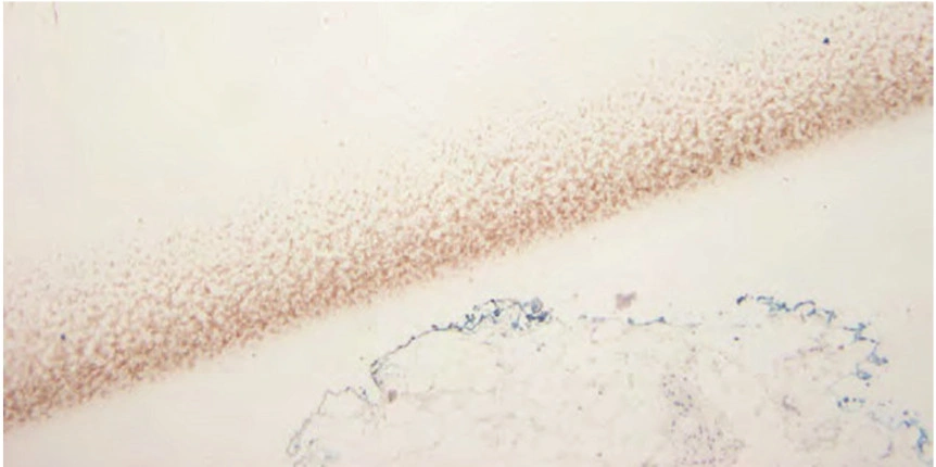 101 kroků: Imunohistochemie (IHC) - BARIA