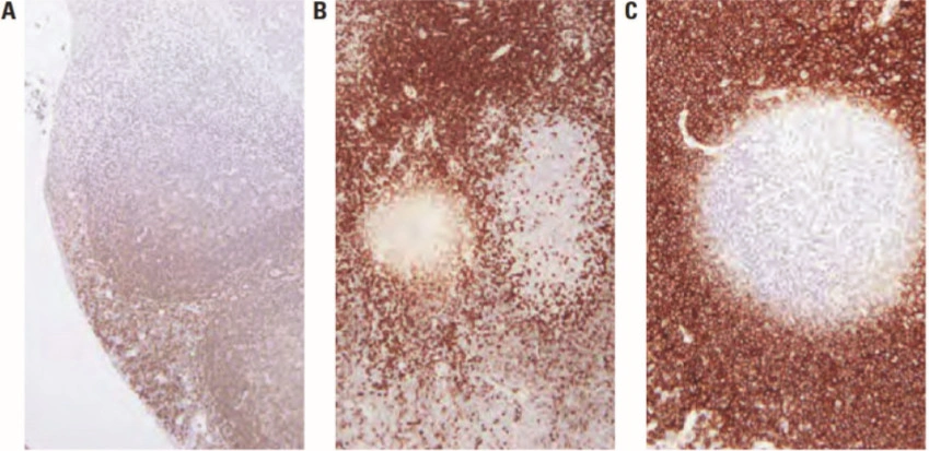 101 kroků: Imunohistochemie (IHC) - BARIA