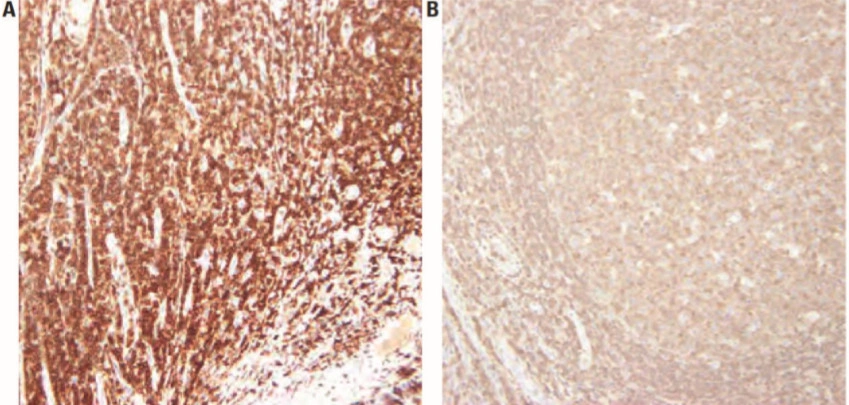 101 kroků: Imunohistochemie (IHC) - BARIA