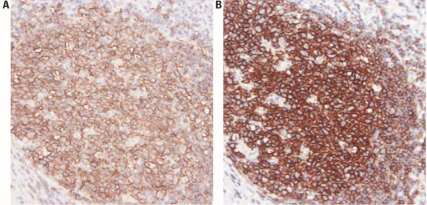 101 kroků: Imunohistochemie (IHC) - BARIA