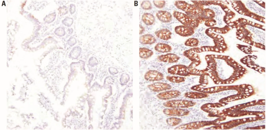101 kroků: Imunohistochemie (IHC) - BARIA