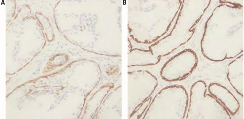 101 kroků: Imunohistochemie (IHC) - BARIA
