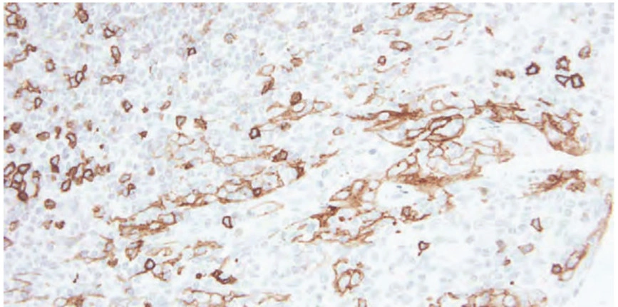 101 kroků: Imunohistochemie (IHC) - BARIA