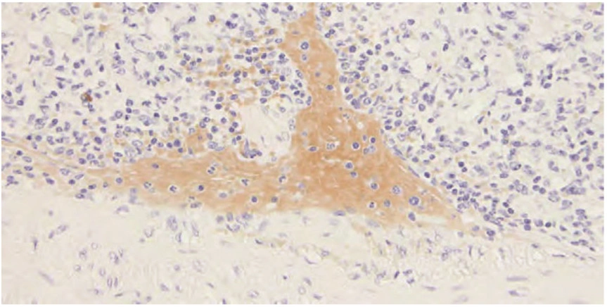 101 kroků: Imunohistochemie (IHC) - BARIA