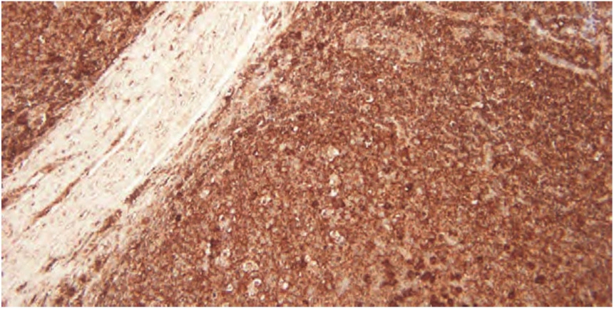 101 kroků: Imunohistochemie (IHC) - BARIA
