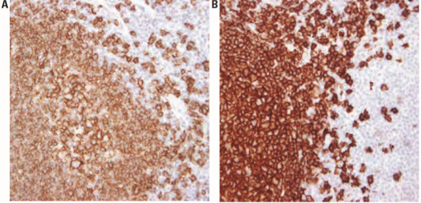 101 kroků: Imunohistochemie (IHC) - BARIA