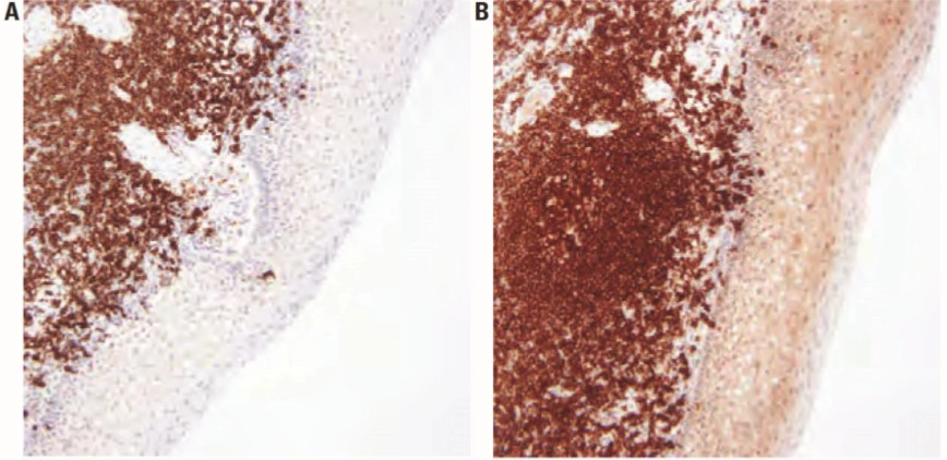 101 kroků: Imunohistochemie (IHC) - BARIA