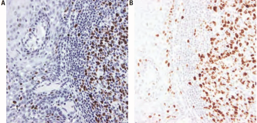 101 kroků: Imunohistochemie (IHC) - BARIA