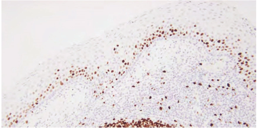 101 kroků: Imunohistochemie (IHC) - BARIA