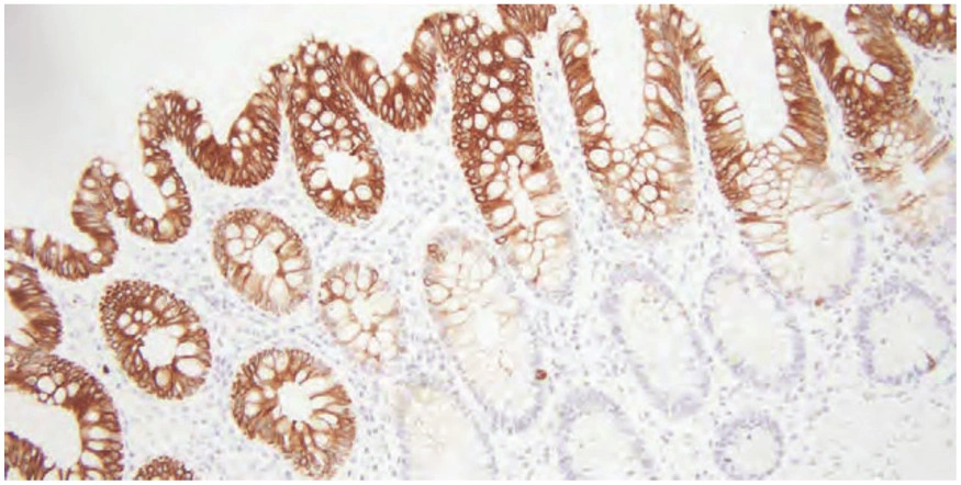 101 kroků: Imunohistochemie (IHC) - BARIA