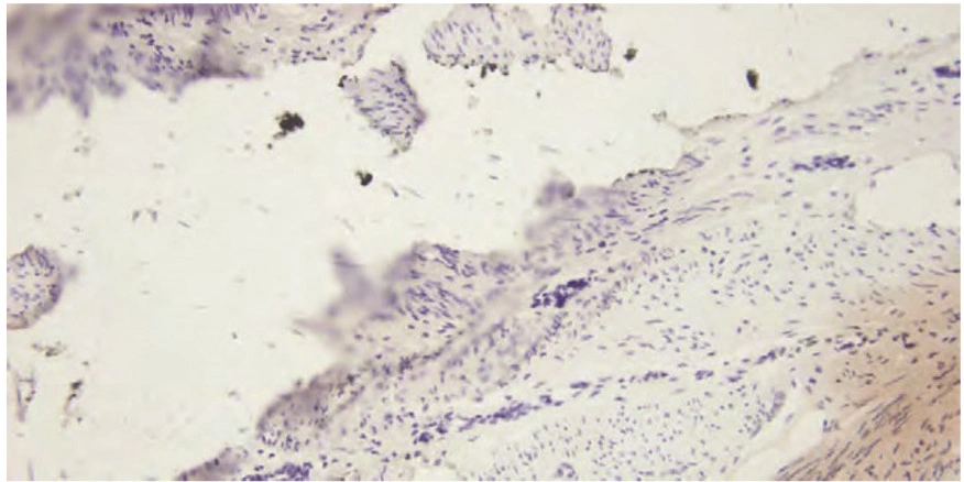 101 kroků: In situ hybridizace (ISH) - BARIA
