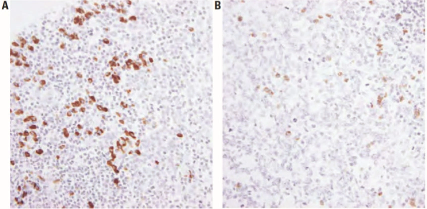 101 kroků: In situ hybridizace (ISH) - BARIA