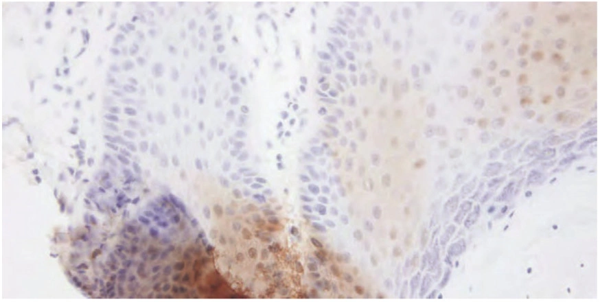 101 kroků: In situ hybridizace (ISH) - BARIA