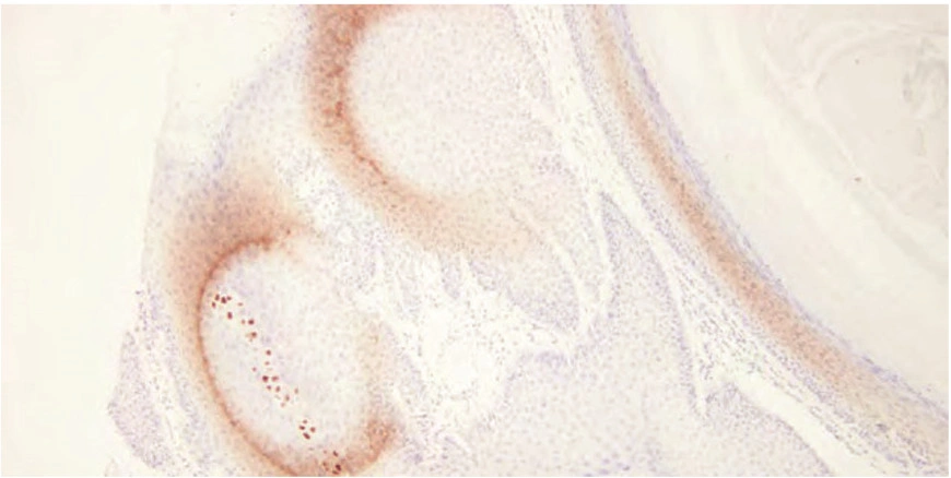 101 kroků: In situ hybridizace (ISH) - BARIA