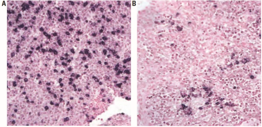 101 kroků: In situ hybridizace (ISH) - BARIA