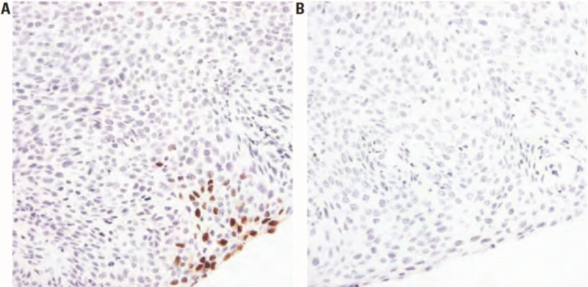 101 kroků: In situ hybridizace (ISH) - BARIA