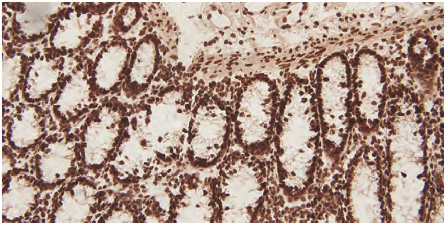 101 kroků: In situ hybridizace (ISH) - BARIA