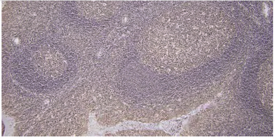 101 kroků: In situ hybridizace (ISH) - BARIA