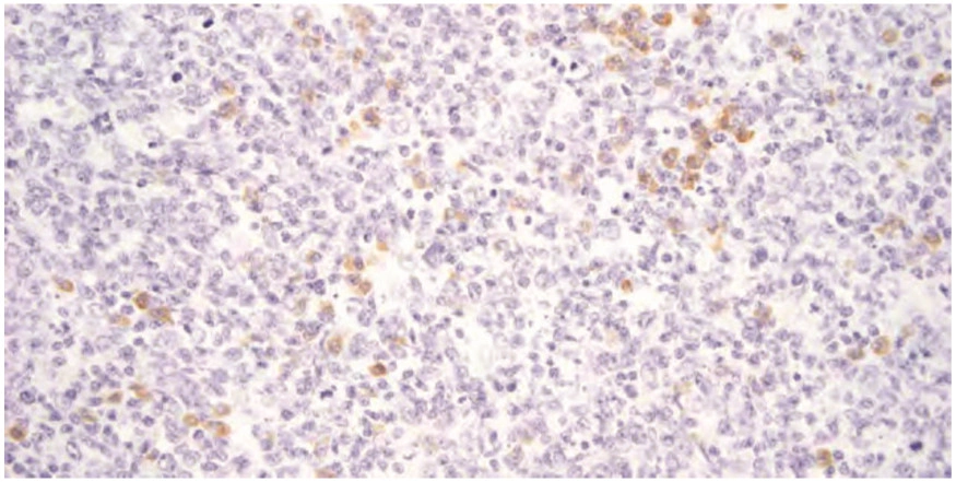 101 kroků: In situ hybridizace (ISH) - BARIA