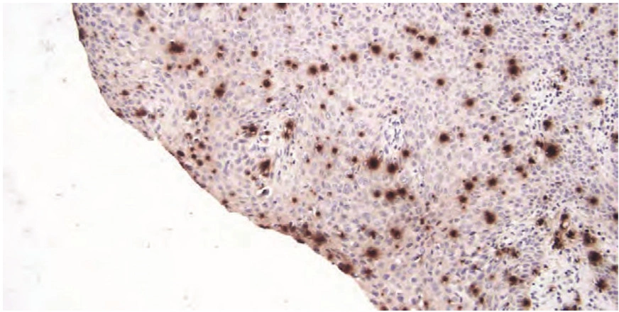 101 kroků: In situ hybridizace (ISH) - BARIA