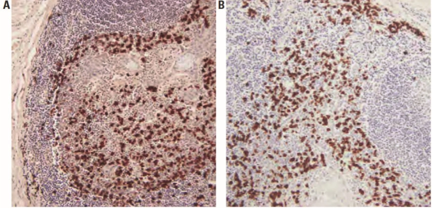 101 kroků: In situ hybridizace (ISH) - BARIA