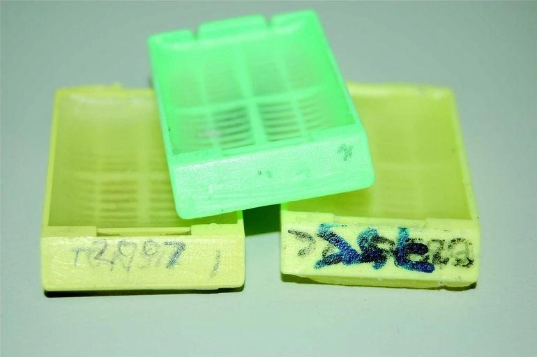 Systémy pro sledování vzorků: sledování vzorků pomáhá snížit pravděpodobnost nesprávné diagnózy - BARIA