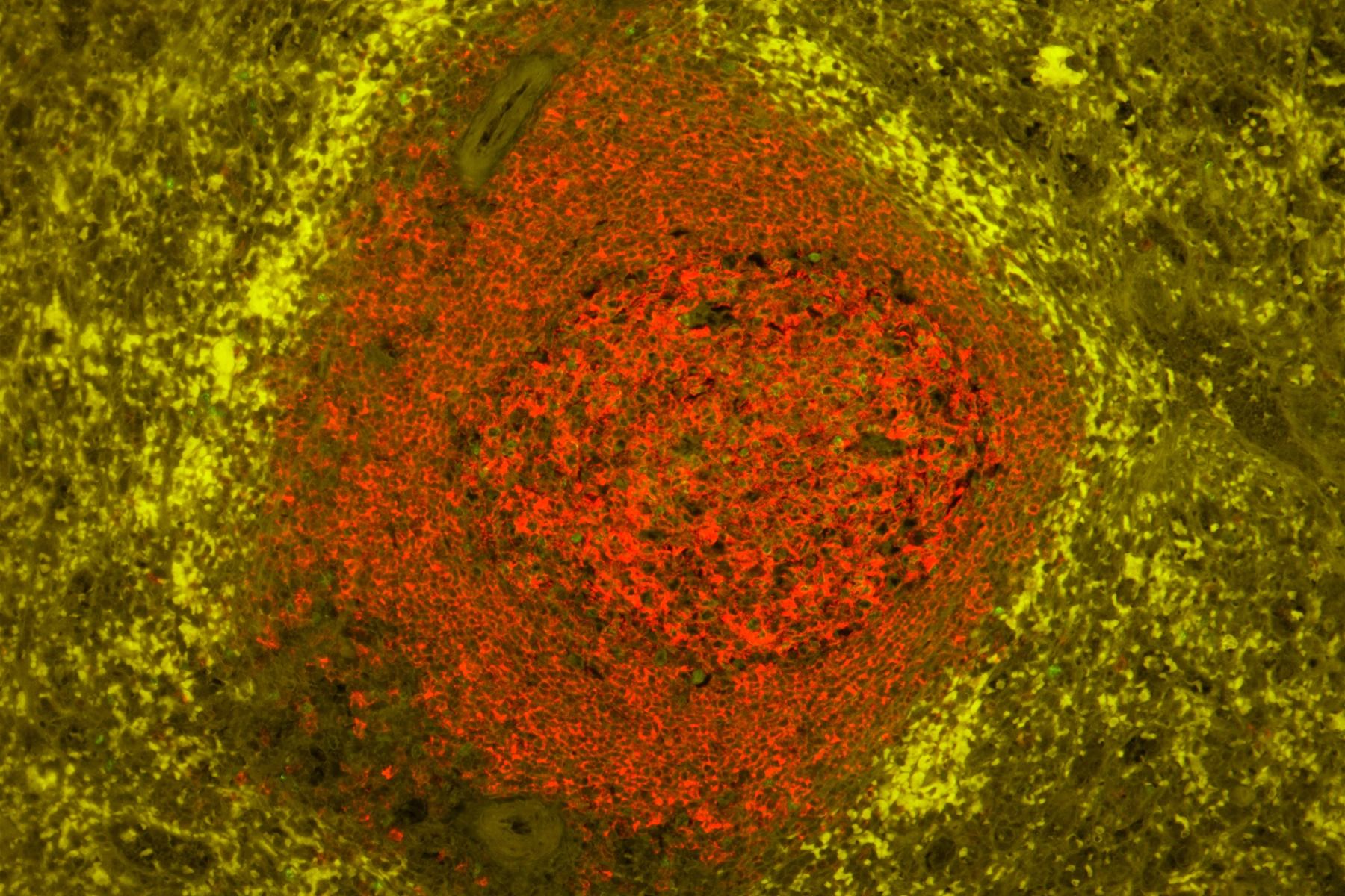 Snížení autofluorescence tkáně a významné zvýšení podílu signálu k šumu – Vector Laboratories - BARIA