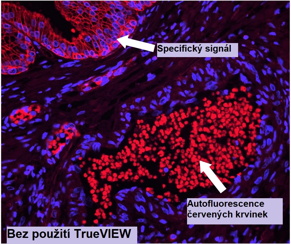 Snížení autofluorescence tkáně a významné zvýšení podílu signálu k šumu – Vector Laboratories - BARIA
