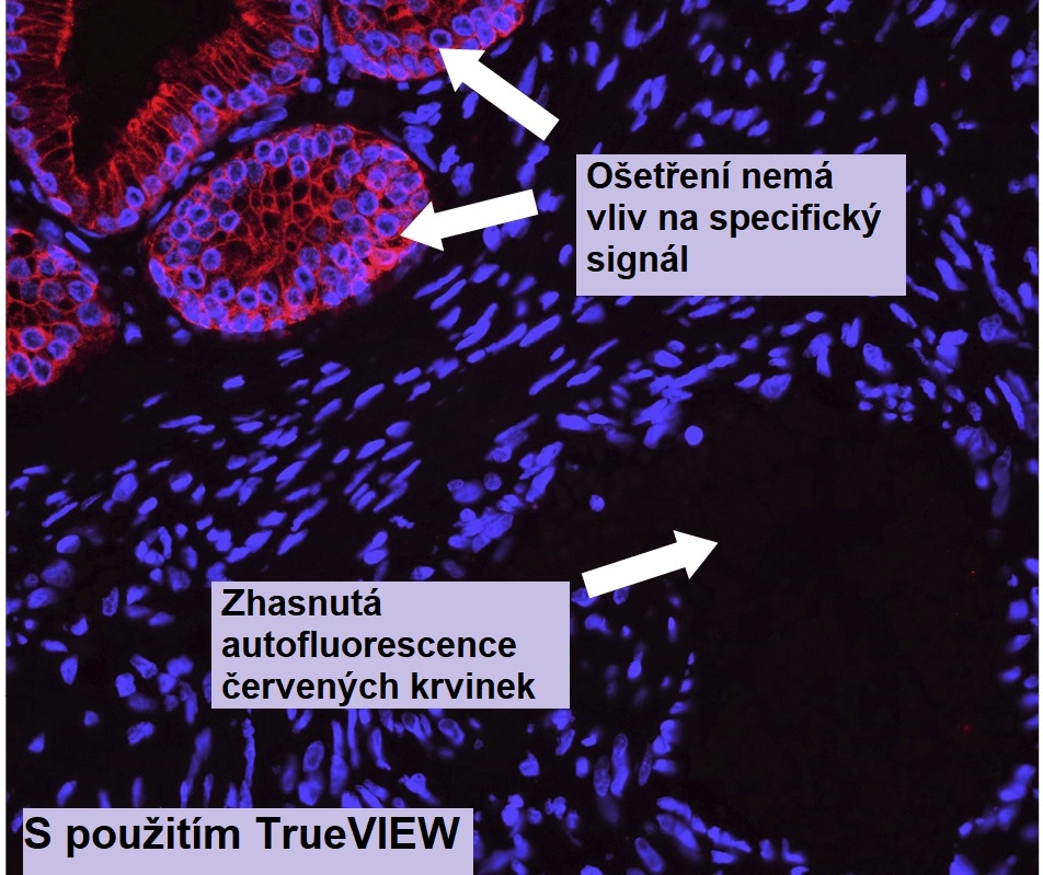 Snížení autofluorescence tkáně a významné zvýšení podílu signálu k šumu – Vector Laboratories - BARIA