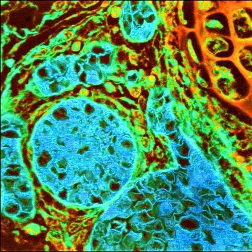 Fluorescenční mikroskopie - BARIA
