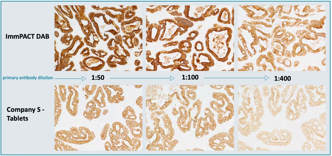 Jednoduchý průvodce výběrem substrátů pro imunohistochemii od společnosti Vector Laboratories - BARIA